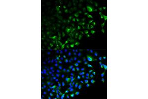 Immunofluorescence analysis of HeLa cells using TRAF2 antibody (ABIN5970352). (TRAF2 Antikörper)