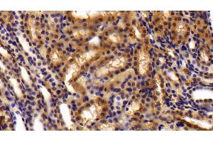 Detection of OLFM4 in Rat Kidney Tissue using Polyclonal Antibody to Olfactomedin 4 (OLFM4) (Olfactomedin 4 Antikörper  (AA 405-511))