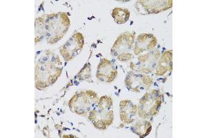 Immunohistochemistry of paraffin-embedded human stomach using USH1C antibody (ABIN5972448) at dilution of 1/100 (40x lens). (USH1C Antikörper)