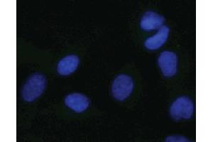 Immunofluorescent staining of HeLa cells. (MAPK14 Antikörper  (pThr180))