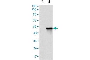 Western blot analysis using TNNI2 monoclonal antobody, clone 2F12G2  against HEK293 (1) and TNNI2 (aa1-182)-hIgGFc transfected HEK293 (2) cell lysate. (TNNI2 Antikörper)