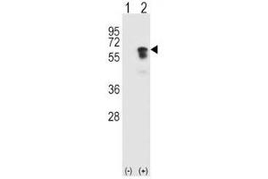 Western blot analysis of ALK2 antibody and 293 cell lysate (2 ug/lane) either nontransfected (Lane 1) or transiently transfected (2) with the ACVR1 gene. (ACVR1 Antikörper  (AA 132-162))