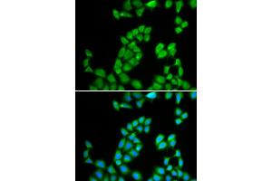 Immunofluorescence analysis of MCF-7 cells using RNASE13 antibody. (RNASE13 Antikörper)