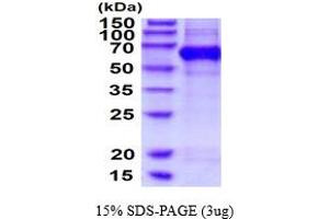 SDS-PAGE (SDS) image for Chromosome 3 Open Reading Frame 64 (C3orf64) (AA 20-527) protein (His tag) (ABIN5854550)