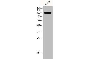 Western Blot analysis of Hela cells using GCN5 Polyclonal Antibody (KAT2A Antikörper  (C-Term))