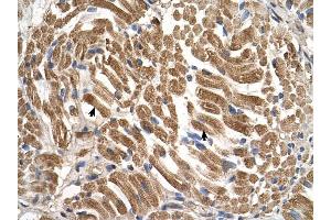 SLC17A5 antibody was used for immunohistochemistry at a concentration of 4-8 ug/ml to stain Skeletal muscle cells (arrows) in Human Muscle.