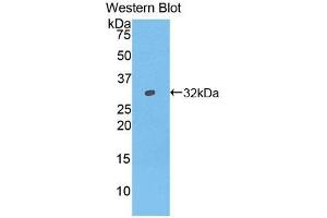 Western blot analysis of the recombinant protein. (IFNAR1 Antikörper  (AA 244-512))