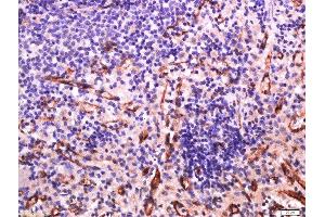 Immunohistochemistry (Paraffin-embedded Sections) (IHC (p)) image for anti-Sialic Acid Binding Ig-Like Lectin 1, Sialoadhesin (SIGLEC1) (AA 851-950) antibody (ABIN2179210)
