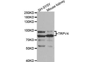 Western blot analysis of extracts of various cell lines, using TRPV4 antibody (ABIN5973304) at 1/1000 dilution. (TRPV4 Antikörper)