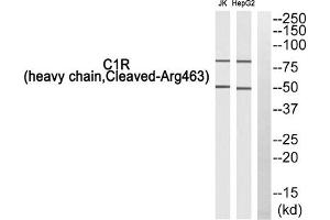 Western blot analysis of extracts from Jurkat cells and HepG2 cells, using C1R (heavy chain, Cleaved-Arg463) antibody. (C1R Antikörper  (Cleaved-Arg463, Heavy Chain))