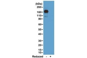 Western blot of nonreduced(-) and reduced(+) mouse IgA, using 0. (Rekombinanter Kaninchen anti-Maus IgA Antikörper)