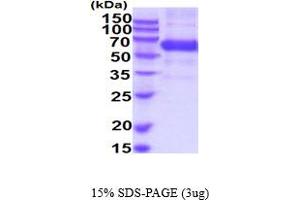 SDS-PAGE (SDS) image for Biotinidase (BTD) (AA 44-545) protein (His tag) (ABIN6387911)