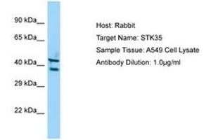 Image no. 1 for anti-Serine/threonine Kinase 35 (STK35) (C-Term) antibody (ABIN6750140) (STK35 Antikörper  (C-Term))