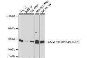 Western blot analysis of extracts of various cell lines, using GABA transaminase (GABA transaminase (ABAT)) Rabbit mAb (ABIN7265336) at 1:1000 dilution. (ABAT Antikörper)