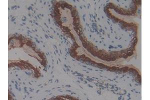 IHC-P analysis of Mouse Vas Deferens Tissue, with DAB staining. (Thymic Stromal Lymphopoietin Antikörper  (AA 21-138))