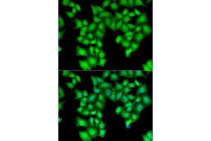 Immunofluorescence analysis of HeLa cell using CPSF3L antibody. (CPSF3L Antikörper)
