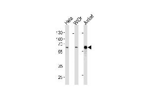HDAC1 Antibody (ABIN1882195 and ABIN2843403) western blot analysis in Hela,WiDr,Jurkat cell line lysates (35 μg/lane).