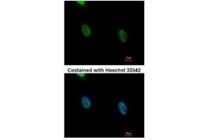 ICC/IF Image Immunofluorescence analysis of paraformaldehyde-fixed HeLa, using hnRNP K, antibody at 1:500 dilution. (HNRNPK Antikörper)