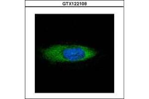 Image no. 2 for anti-Heat Shock Protein 70kDa Family, Member 13 (HSPA13) (AA 204-423) antibody (ABIN1498740) (HSPA13 Antikörper  (AA 204-423))