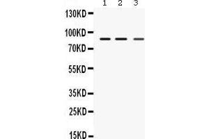 Western Blotting (WB) image for anti-Mediterranean Fever (MEFV) (AA 5-39), (N-Term) antibody (ABIN3042357) (MEFV Antikörper  (N-Term))