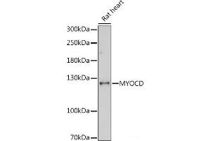 Western blot analysis of extracts of Rat heart using MYOCD Polyclonal Antibody at dilution of 1:1000. (Myocardin Antikörper)
