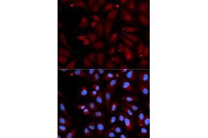 Immunofluorescence analysis of U2OS cell using MAOB antibody. (Monoamine Oxidase B Antikörper)