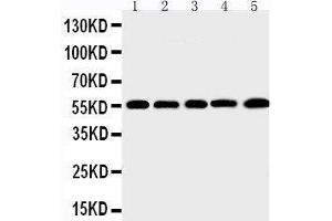 Anti-MMP12 antibody, Western blotting Lane 1: SMMC Cell Lysate Lane 2: HEPA Cell Lysate Lane 3: HELA Cell Lysate Lane 4: K562 Cell Lysate Lane 5: MCF-7 Cell Lysate (MMP12 Antikörper  (C-Term))