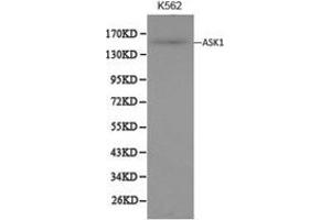Western Blotting (WB) image for anti-Mitogen-Activated Protein Kinase Kinase Kinase 5 (MAP3K5) antibody (ABIN1873617) (ASK1 Antikörper)
