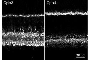 Indirect immunostaining of mouse retina with rabbit polyclonal antibodies against complexin 3 (cat. (Complexin 4 Antikörper)