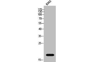 Western Blot analysis of K562 cells using GUSBP1 Polyclonal Antibody (GUSBP1 Antikörper  (Internal Region))