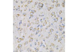 Immunohistochemistry of paraffin-embedded rat brain using IL10RA Antibody (ABIN3022614, ABIN3022615, ABIN3022616, ABIN1513078 and ABIN6218954) at dilution of 1:100 (40x lens). (IL-10RA Antikörper  (AA 22-230))