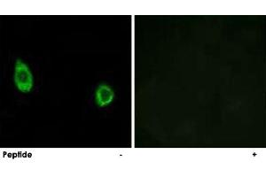 Immunofluorescence analysis of HUVEC cells, using CHST9 polyclonal antibody . (CHST9 Antikörper)