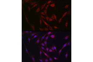 Immunofluorescence analysis of NIH/3T3 cells using FGF23 antibody (ABIN6127894, ABIN6140600, ABIN6140602 and ABIN6221721) at dilution of 1:25. (FGF23 Antikörper  (AA 25-251))