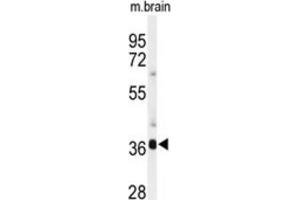 Western Blotting (WB) image for anti-Sirtuin 3 (SIRT3) antibody (ABIN2911469) (SIRT3 Antikörper)