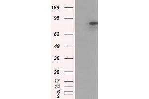 HEK293T cells were transfected with the pCMV6-ENTRY control (Left lane) or pCMV6-ENTRY CDH13 (Right lane) cDNA for 48 hrs and lysed. (Cadherin 13 Antikörper)