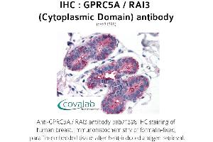 Image no. 1 for anti-G Protein-Coupled Receptor, Family C, Group 5, Member A (GPRC5A) (1st Cytoplasmic Domain) antibody (ABIN1735206) (GPRC5A Antikörper  (1st Cytoplasmic Domain))