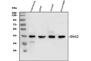 Western blot analysis of C1QBP using anti-C1QBP antibody (ABIN3043833).