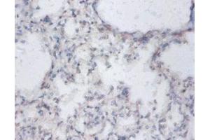Immunohistochemistry of paraffin-embedded human lung tissue using ABIN7149863 at dilution of 1:100 (SAT1 Antikörper  (AA 5-171))