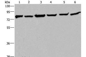 Western Blot analysis of Mouse kidney tissue, HT-29, A549, 293T, MCF-7 and Hela cell using HSPA9 Polyclonal Antibody at dilution of 1:400 (HSPA9 Antikörper)
