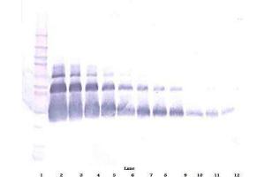 Image no. 1 for anti-Vascular Endothelial Growth Factor A (VEGFA) antibody (Biotin) (ABIN465275) (VEGFA Antikörper  (Biotin))