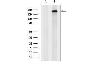 anti-Alstrom Syndrome 1 (ALMS1) (C-Term) antibody