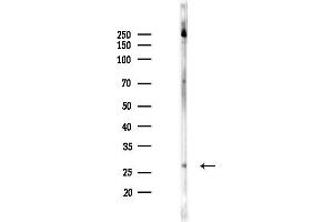 Western blot analysis of lysates from Rat brain, using TPPP Antibody at 1/1000 dilution.