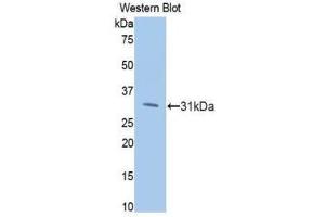 Western Blotting (WB) image for anti-Phosphoinositide-3-Kinase, Catalytic, beta Polypeptide (PIK3CB) (AA 807-1070) antibody (ABIN1860220)