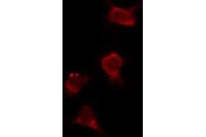 ABIN6274036 staining Hela by IF/ICC.