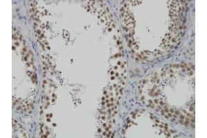 Immunoperoxidase of monoclonal antibody to DDX26 on formalin-fixed paraffin-embedded human testis. (INTS6 Antikörper  (AA 779-887))