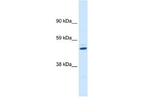 KCNAB1 antibody used at 1 ug/ml to detect target protein. (KCNAB1 Antikörper  (C-Term))