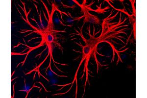 Mixed cultures of neurons and glia stained with GFAP antibody (red), and DNA (blue). (GFAP Antikörper)