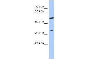 Western Blotting (WB) image for anti-Tropomyosin 3 (TPM3) antibody (ABIN2458556)