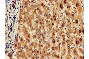 Immunohistochemistry of paraffin-embedded human liver tissue using ABIN7162155 at dilution of 1:100 (OLFML3 Antikörper  (AA 201-406))