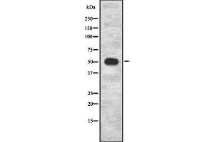 Western blot analysis of PCYOX1 using Jurkat whole cell lysates (PCYOX1 Antikörper  (Internal Region))